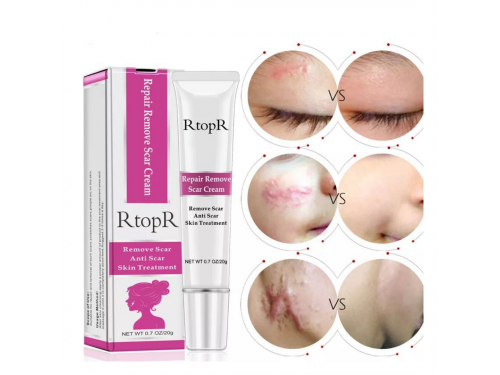 Creme Para Remover Cicatriz E Acne RtopR 20g